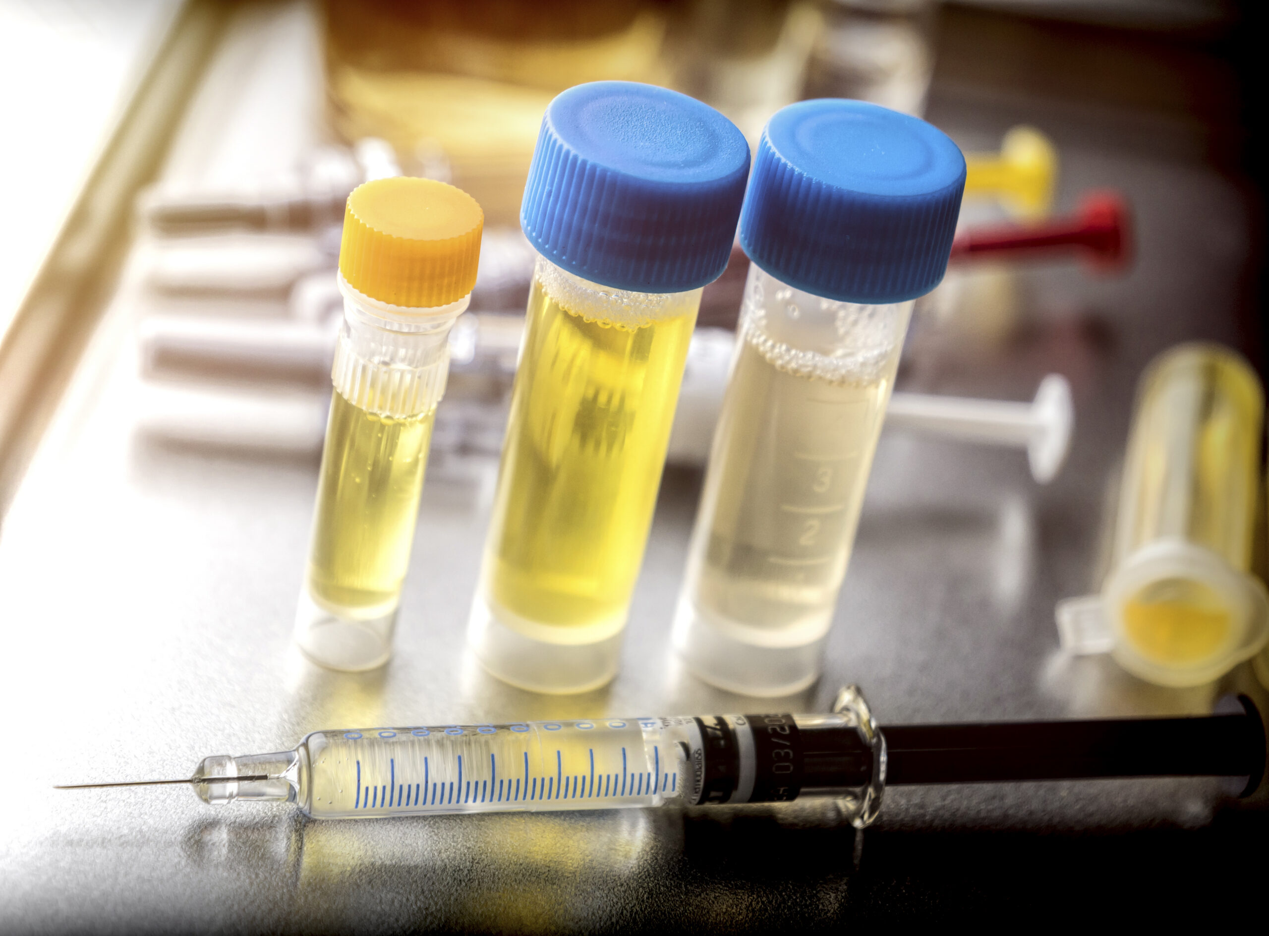 Medical vials and syringe prepared for an injection-based treatment.